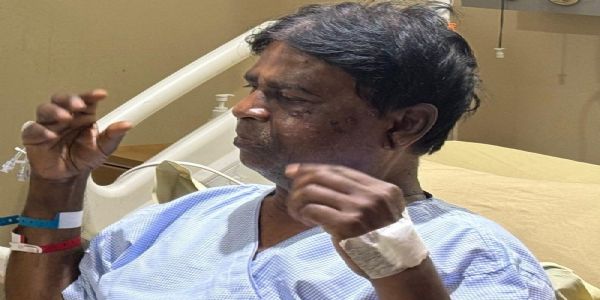 BJP MP Khagen Murmu alleges conspiracy to kill him in Jalpaiguri attack