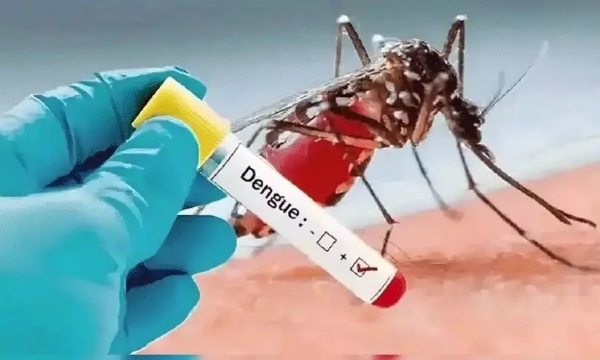Dengue fever Dengue fever