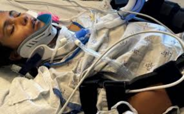 Young Indian Woman in Coma After San Jose Accident; Father Struggles Alone as Community Rallies Young Indian Woman in Coma After San Jose Accident; Father Struggles Alone as Community Rallies