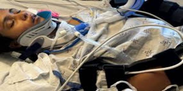 Young Indian Woman in Coma After San Jose Accident; Father Struggles Alone as Community Rallies