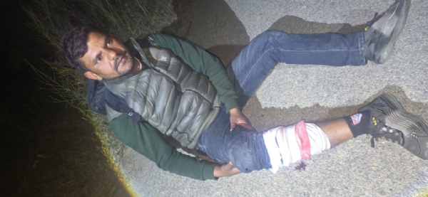 Both of them were shot in the legs by the police