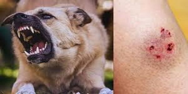 Nine-Year-Old Boy Attacked by Stray Dog in Ramapuram
