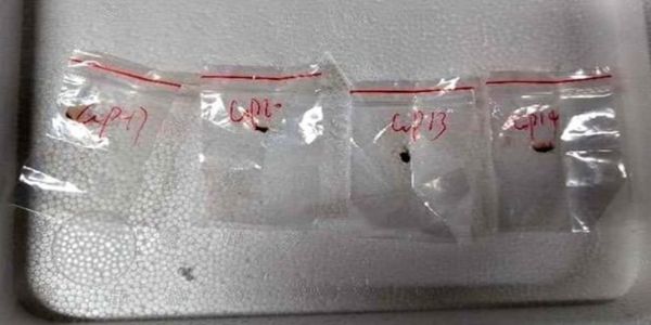Two Chinese nationals charged with smuggling dangerous fungus in US