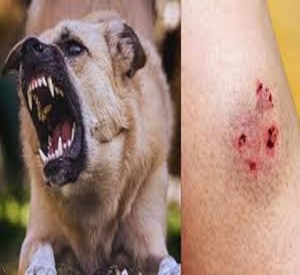 Rabid Dog Attacks Over 20 People in Mayiladuthurai in a Single Day