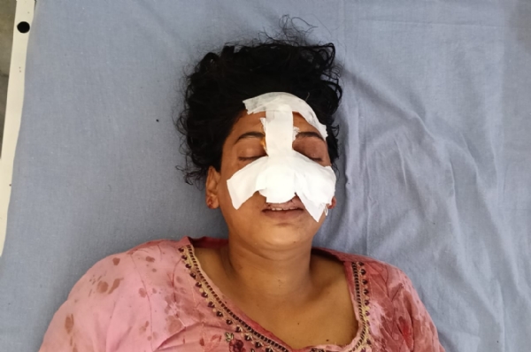Victim referred to Meerut Higher Center