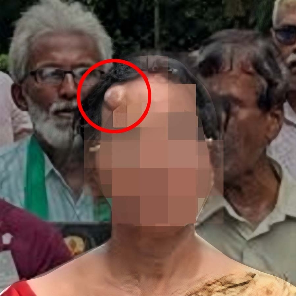RG kar victim mother