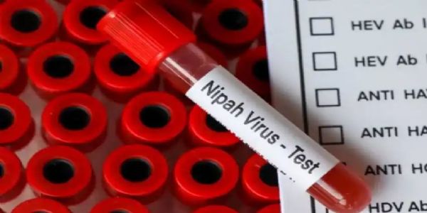 Condition of Both Nipah-Infected Nurses Improves, Indications of a Common Source of Infection