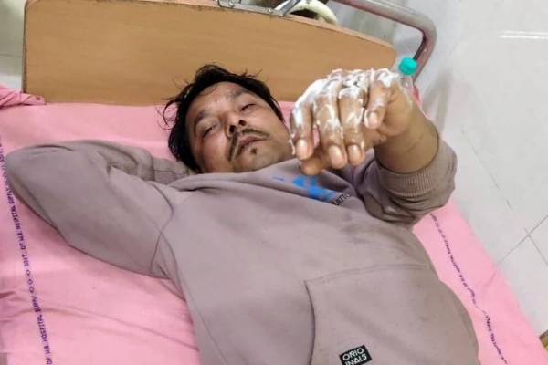 The injured TMC worker