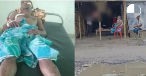 Image of the Injured In Clash Between Two Butcher Groups In Nagaon.