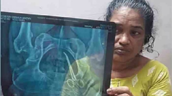 Usha Joseph Usha Joseph