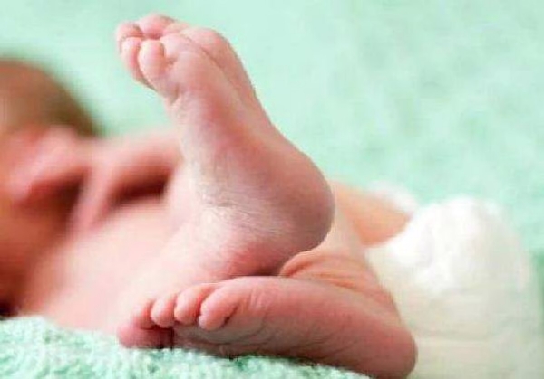 Representative image Representative image