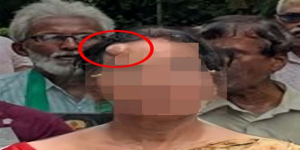 RG Kar Doctor Case: Victim’s Parents Say Justice Possible Only After Change In Bengal Government