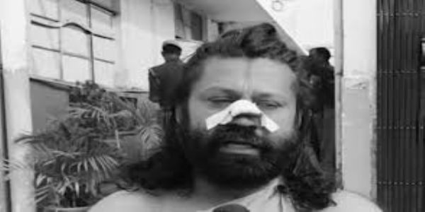 Ashutosh Brahmachari attacked with razor onboard train in UP