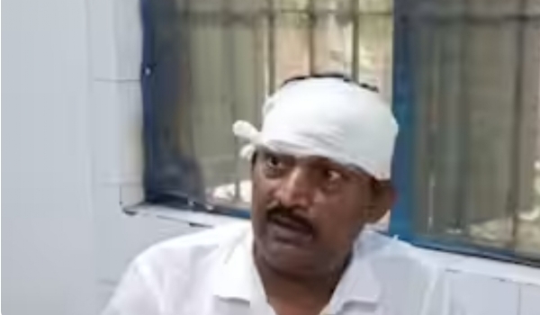 The injured BJP polling agent