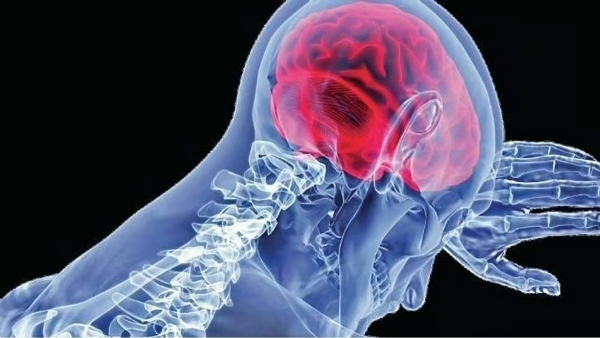 Ameobic encephalitis