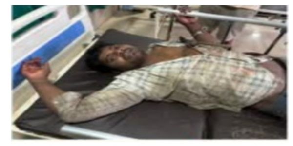 Both Legs and One Hand Badly Crushed of the Robbery Accused