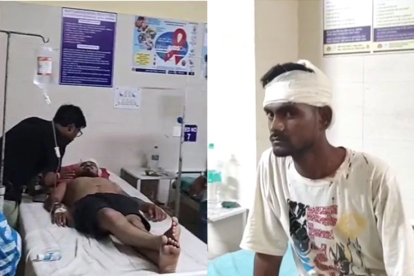 The injured BJP workers