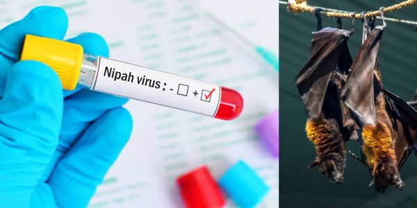 Nipah case confirmed in Kozhikode; Patient shifted to isolation ward