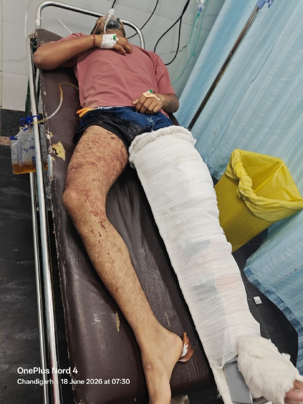 Under treatment accused