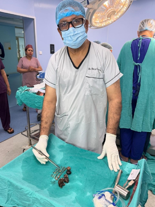 Doctors successfully removed 37 stones from the left kidney of a 40-year-old patient