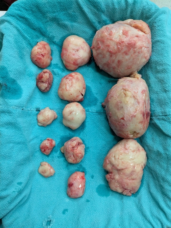 Dr. Shakti Jain and his team performed the operation with utmost care Dr. Shakti Jain and his team performed the operation with utmost care